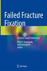 Book cover of Failed Fracture Fixation by Peter V. Giannoudis