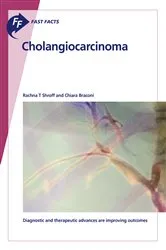Book cover of Fast Facts: Cholangiocarcinoma by Rachna T. Shroff