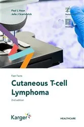 Book cover of Fast Facts: Cutaneous T-cell Lymphoma (2nd ed.) by Paul L. Haun