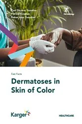 Book cover of Fast Facts: Dermatoses in Skin of Color by Paul Devakar Yesudian