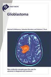 Book cover of Fast Facts: Glioblastoma by Mairéad McNamara