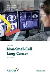 Book cover of Fast Facts: Non-Small-Cell Lung Cancer (2nd ed.) by Unknown