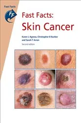 Book cover of Fast Facts: Skin Cancer (2nd ed.) by Karen L. Agnew