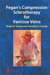 Book cover of Fegan’s Compression Sclerotherapy for Varicose Veins by Shukri K. Shami