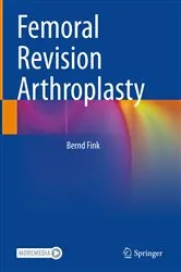 Book cover of Femoral Revision Arthroplasty by Bernd Fink