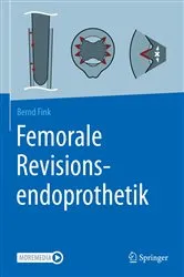 Book cover of Femorale Revisionsendoprothetik by Bernd Fink