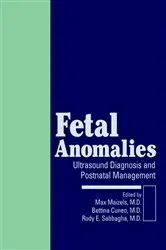 Book cover of Fetal Anomalies by Max Maizels