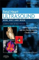 Book cover of Fetal Heart Ultrasound - E-Book (2nd ed.) by Catherine Fredouille MD