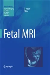 Book cover of Fetal MRI by Daniela Prayer