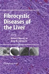 Book cover of Fibrocystic Diseases of the Liver by Karen F. Murray