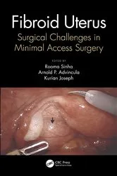 Book cover of Fibroid Uterus by Rooma Sinha
