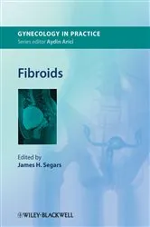 Book cover of Fibroids by James H. Segars