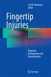 Book cover of Fingertip Injuries by Leo M. Rozmaryn