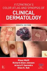 Book cover of Fitzpatrick's Color Atlas and Synopsis of Clinical Dermatology, Eighth Edition (8th ed.) by Klaus Wolff