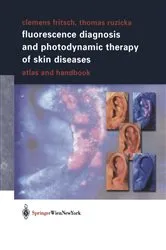 Book cover of Fluorescence Diagnosis and Photodynamic Therapy of Skin Diseases by Clemens Fritsch