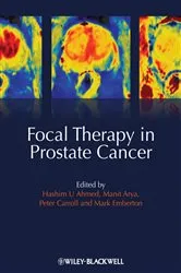 Book cover of Focal Therapy in Prostate Cancer by Hashim Uddin Ahmed