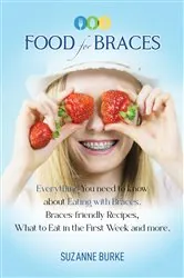 Book cover of Food for Braces by Suzanne Burke