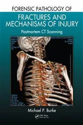 Book cover of Forensic Pathology of Fractures and Mechanisms of Injury by Michael P. Burke