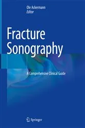 Book cover of Fracture Sonography by Ole Ackermann