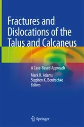Book cover of Fractures and Dislocations of the Talus and Calcaneus by Mark R. Adams