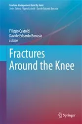 Book cover of Fractures Around the Knee by Filippo Castoldi