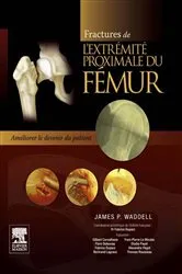 Book cover of Fractures de l'extrémité proximale du fémur by James P. Waddell