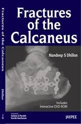 Book cover of Fractures of the Calcaneus by Mandeep S. Dhillon