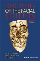Book cover of Fractures of the Facial Skeleton (2nd ed.) by Michael Perry