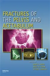 Book cover of Fractures of the Pelvis and Acetabulum by Unknown