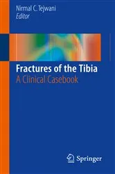 Book cover of Fractures of the Tibia by Unknown