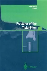 Book cover of Fractures of the Tibial Pilon by Unknown