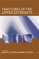 Book cover of Fractures of the Upper Extremity by Bruce H. Ziran
