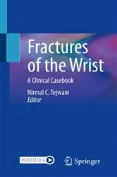 Book cover of Fractures of the Wrist by Nirmal C. Tejwani