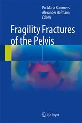 Book cover of Fragility Fractures of the Pelvis by Pol Maria Rommens