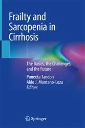 Book cover of Frailty and Sarcopenia in Cirrhosis by Puneeta Tandon