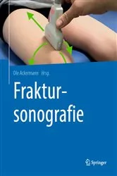 Book cover of Fraktursonografie by Ole Ackermann