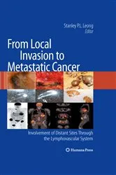 Book cover of From Local Invasion to Metastatic Cancer by Unknown