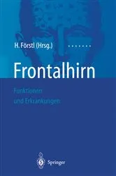Book cover of Frontalhirn by Hans Förstl
