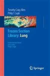 Book cover of Frozen Section Library: Lung by Timothy Craig Allen