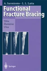 Book cover of Functional Fracture Bracing by Augusto Sarmiento