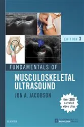 Book cover of Fundamentals of Musculoskeletal Ultrasound E-Book (3rd ed.) by Jon A. Jacobson MD