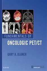 Book cover of Fundamentals of Oncologic PET/CT E-Book by Ulaner MD, PhD, FACNM, Gary A.
