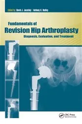 Book cover of Fundamentals of Revision Hip Arthroplasty by David Jacofsky