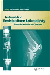 Book cover of Fundamentals of Revision Knee Arthroplasty by David Jacofsky