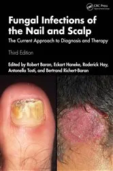 Book cover of Fungal Infections of the Nail and Scalp (3rd ed.) by Robert Baran