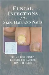 Book cover of Fungal Infections of the Skin and Nails by Raimo E. Suhonen