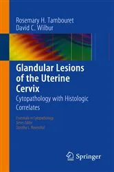 Book cover of Glandular Lesions of the Uterine Cervix by Rosemary H. Tambouret