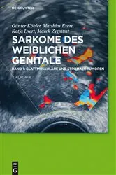 Book cover of Glattmuskuläre und stromale Tumoren (2nd ed.) by Günter Köhler