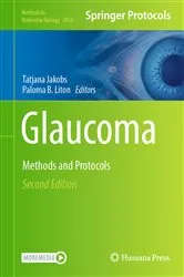 Book cover of Glaucoma (2nd ed.) by Tatjana Jakobs