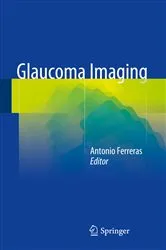Book cover of Glaucoma Imaging by Antonio Ferreras